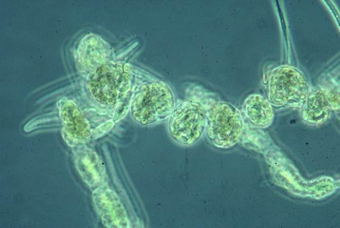 Cyanobacteria, Large Images